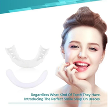 Load image into Gallery viewer, รั้งฟัน Magic ™