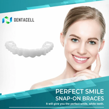 Load image into Gallery viewer, Magic Teeth Brace™